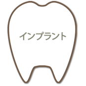 インプラント