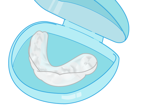 マウスピース矯正