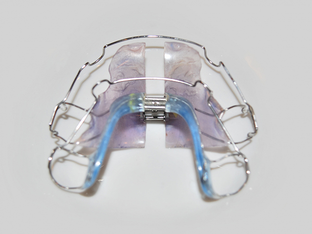 床矯正（小児矯正）