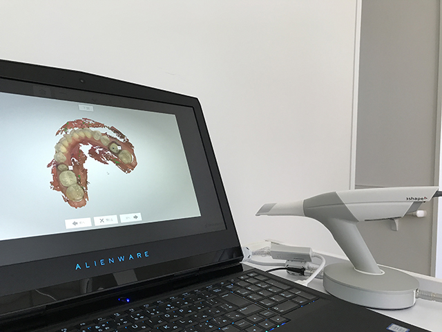 口腔内スキャナーで型取り