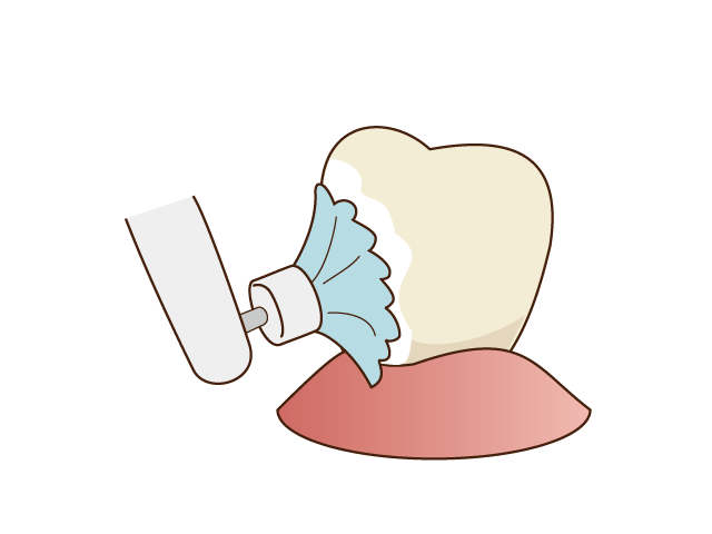 PMTC（プロフェッショナル メカンカル トゥース クリーニング）